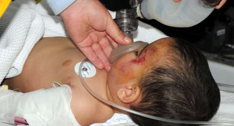 Balkondan düşen 2 yaşındaki Kerem ağır yaralandı