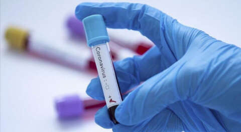 Fransa'da koronavirüs kurbanı bin 696'ya çıktı