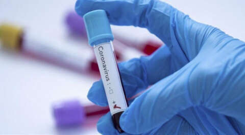 İSİG: Mart ayında 14 işçi koronavirüsten öldü