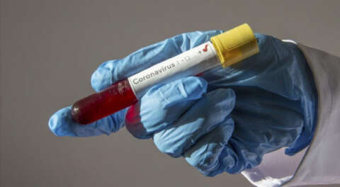 Kovid-19'u ağır geçirenlerin genetik şifresi çözüldü