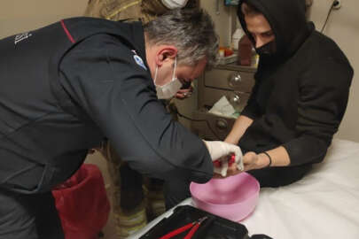 Parmakta sıkışan yüzüğü itfaiye çıkarttı