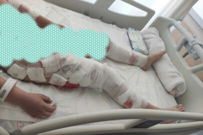 Bursa'da köpeklerin saldırısına uğrayan çocuk ölümden döndü