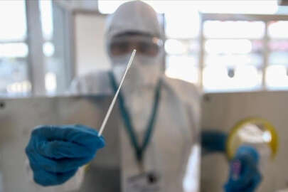 1858 kişinin Kovid-19 testi pozitif çıktı, 7 kişi hayatını kaybetti