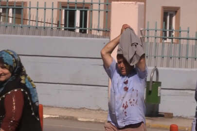 'Acemi kasaplar' soluğu hastanelerde aldı