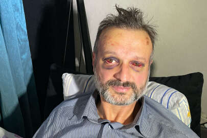 Mudanya'da eğlence mekanında piyanisti yaralayan 9 şüpheli serbest kaldı