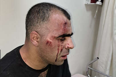 Gazeteci Sinan Aygül'ü darp eden koruma ve polis tutuklandı