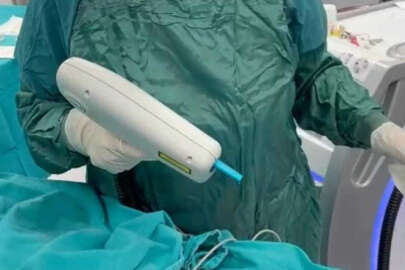 Bursa Şehir Hastanesi'nde yanık izleri lazerle tedavi ediliyor