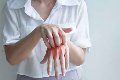 Uyuz vakaları da söylentiler de arttı: ‘Hayvandan insana bulaşmaz’