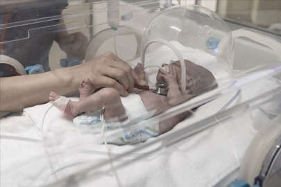 Türkiye'de geçen yıl 127 bin bebek prematüre doğdu