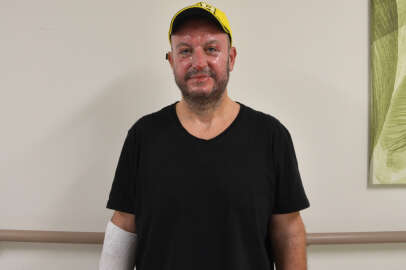 Oksijen tüpünün patlamasıyla yanan amca ve yeğeninin tedavisi sürüyor