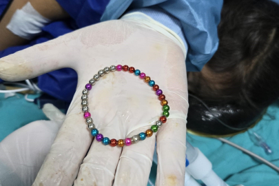 5 yaşındaki çocuğun bağırsağından 38 adet mıknatıs çıkarıldı