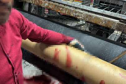 Silindir makinasına elini kaptıran işçi ağır yaralandı