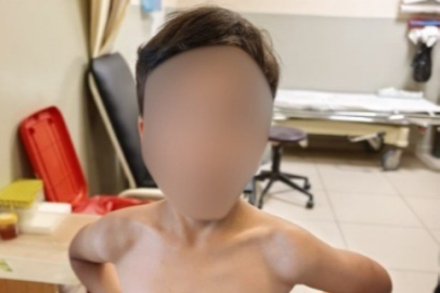 İnegöl'de kene alarmı